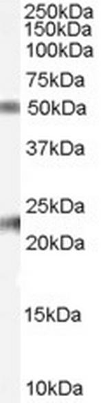 Fibulin 5 Antibody in Western Blot (WB)