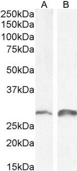 SNAIL Antibody in Western Blot (WB)