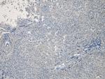 CPT1A Antibody in Immunohistochemistry (Paraffin) (IHC (P))