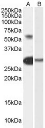 TCFL5 Antibody in Western Blot (WB)