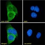 CCM2 Antibody in Immunocytochemistry (ICC/IF)