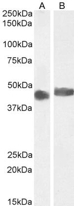 CCM2 Antibody in Western Blot (WB)