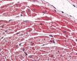 PIK3CA Antibody in Immunohistochemistry (Paraffin) (IHC (P))