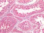 PIK3CA Antibody in Immunohistochemistry (Paraffin) (IHC (P))