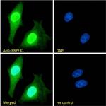 PRPF31 Antibody in Immunocytochemistry (ICC/IF)