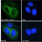 CRHR1 Antibody in Immunocytochemistry (ICC/IF)