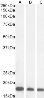 ARF1/ARF2/ARF3/ARF4 Antibody in Western Blot (WB)