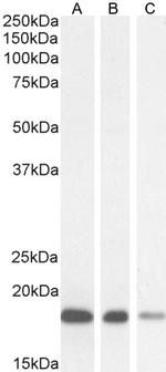 ARF1/ARF2/ARF3/ARF4 Antibody in Western Blot (WB)