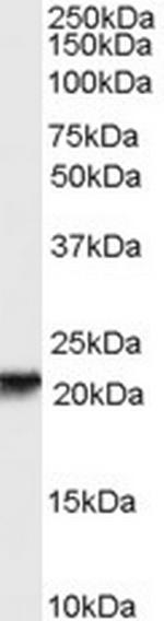 RBP4 Antibody in Western Blot (WB)