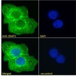 DGAT1 Antibody in Immunocytochemistry (ICC/IF)