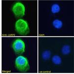 LARP2 Antibody in Immunocytochemistry (ICC/IF)