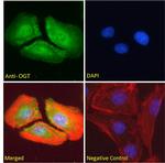 OGT Antibody in Immunocytochemistry (ICC/IF)