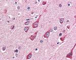 OGT Antibody in Immunohistochemistry (Paraffin) (IHC (P))