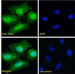 DIO2 Antibody in Immunocytochemistry (ICC/IF)