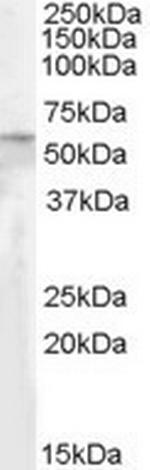 ATGL Antibody in Western Blot (WB)