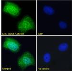 CGI58 Antibody in Immunocytochemistry (ICC/IF)