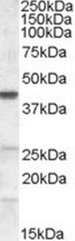 CGI58 Antibody in Western Blot (WB)