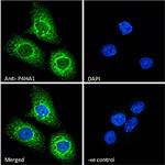 P4HA1 Antibody in Immunocytochemistry (ICC/IF)