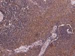 P4HA1 Antibody in Immunohistochemistry (Paraffin) (IHC (P))