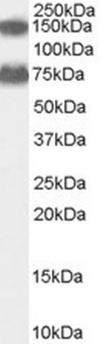 ACOX2 Antibody in Western Blot (WB)