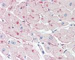 ATGL Antibody in Immunohistochemistry (Paraffin) (IHC (P))