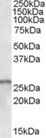 SMN1/SMN2 Antibody in Western Blot (WB)