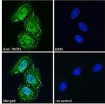 TACR1 Antibody in Immunocytochemistry (ICC/IF)