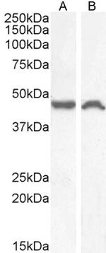 TACR1 Antibody in Western Blot (WB)