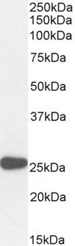 PAX6 Antibody in Western Blot (WB)