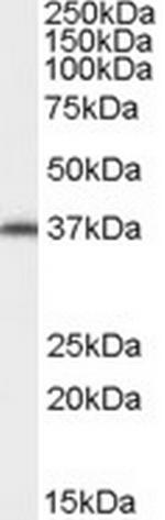 AIP Antibody in Western Blot (WB)