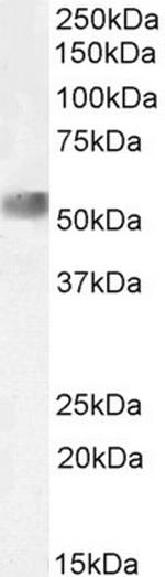 NR0B1 Antibody in Western Blot (WB)