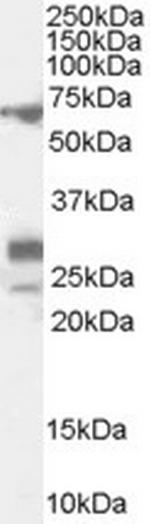 SALL4 Antibody in Western Blot (WB)