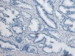 CD26 Antibody in Immunohistochemistry (Paraffin) (IHC (P))