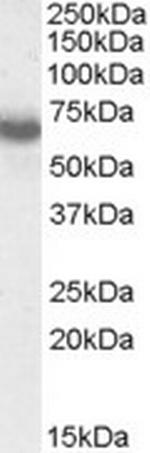 IKAROS Antibody in Western Blot (WB)