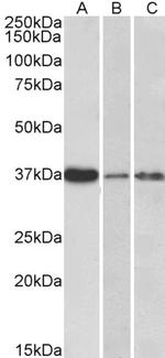 IL-12 p40 Antibody in Western Blot (WB)