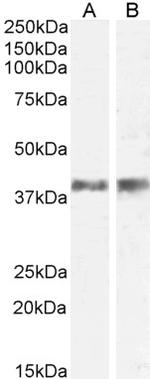 IL-12 p40 Antibody in Western Blot (WB)