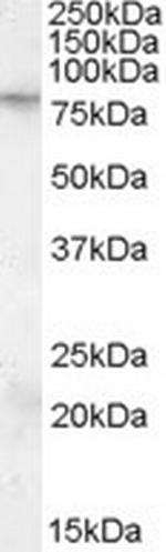 FMRP Antibody in Western Blot (WB)