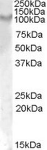 IL17RA Antibody in Western Blot (WB)