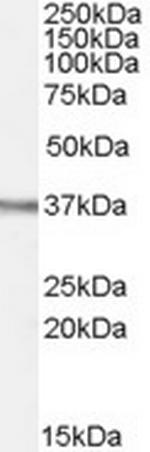 OGG1 Antibody in Western Blot (WB)