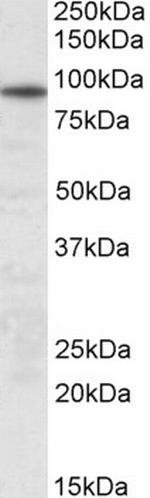 UNC45B Antibody in Western Blot (WB)