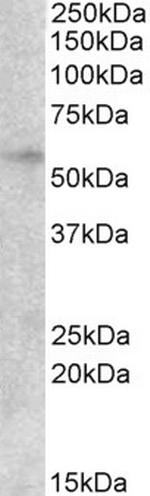 EGR2 Antibody in Western Blot (WB)