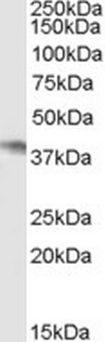 NCF4 Antibody in Western Blot (WB)