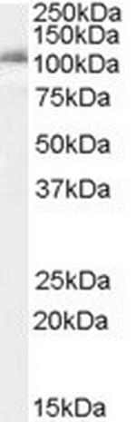 IDE Antibody in Western Blot (WB)