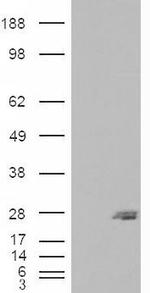 SAR1B Antibody in Western Blot (WB)