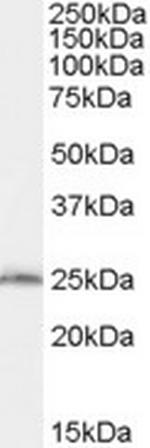 SAR1B Antibody in Western Blot (WB)