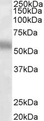 TFEB Antibody in Western Blot (WB)