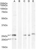 B7-H4 Antibody in Western Blot (WB)