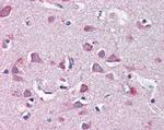 NF2 Antibody in Immunohistochemistry (Paraffin) (IHC (P))