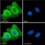 SAP97 Antibody in Immunocytochemistry (ICC/IF)