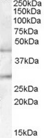 B3GNT2 Antibody in Western Blot (WB)